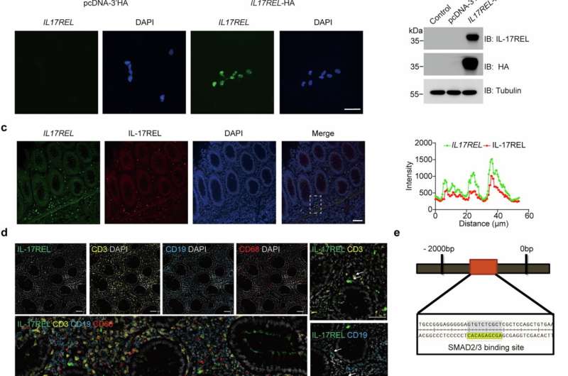 Breakthrough Discovery: Natural Protein Shield Could Transform IBD Treatment - Image 3