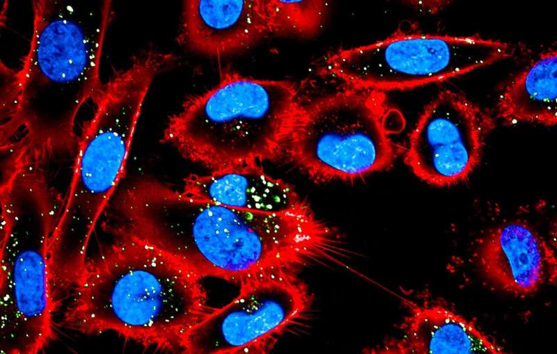 Finnish Scientists Find Way to Stop Melanoma's Growth Cycle - Image 3