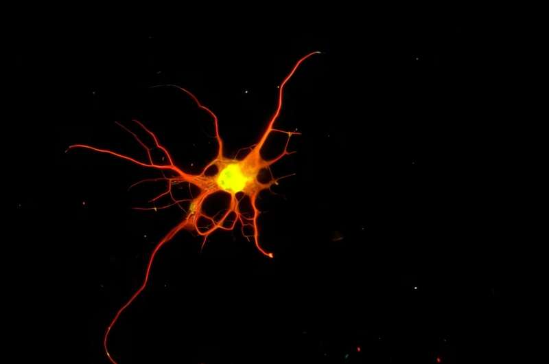 Harvard Scientists Grow Brain Cells That Could Treat ALS - Image 2