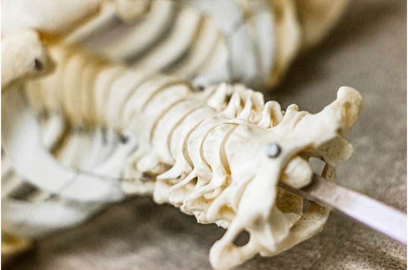 AI Model Predicts Spine Cancer Survival with 76% Accuracy - Image 3