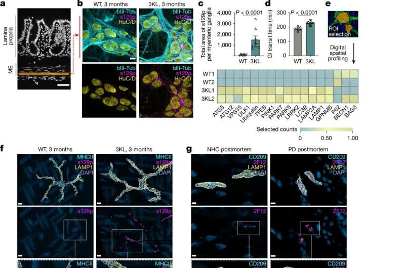 Gut Immune Cells May Stop Parkinson's Before Brain Damage - Image 3