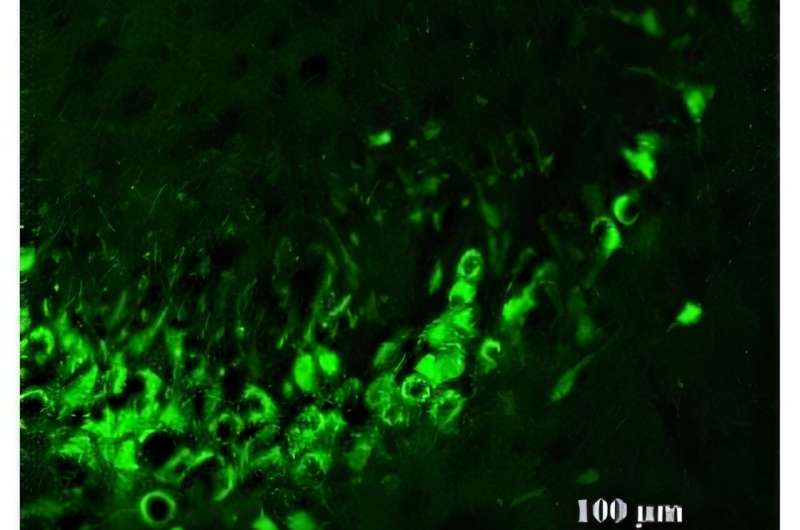 New Peptide Reduces Seizures in Drug-Resistant Epilepsy - Image 2