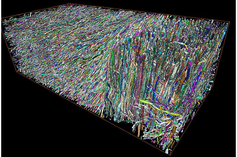 MRI Breakthrough Detects Brain Damage at Microscopic Level - Image 2