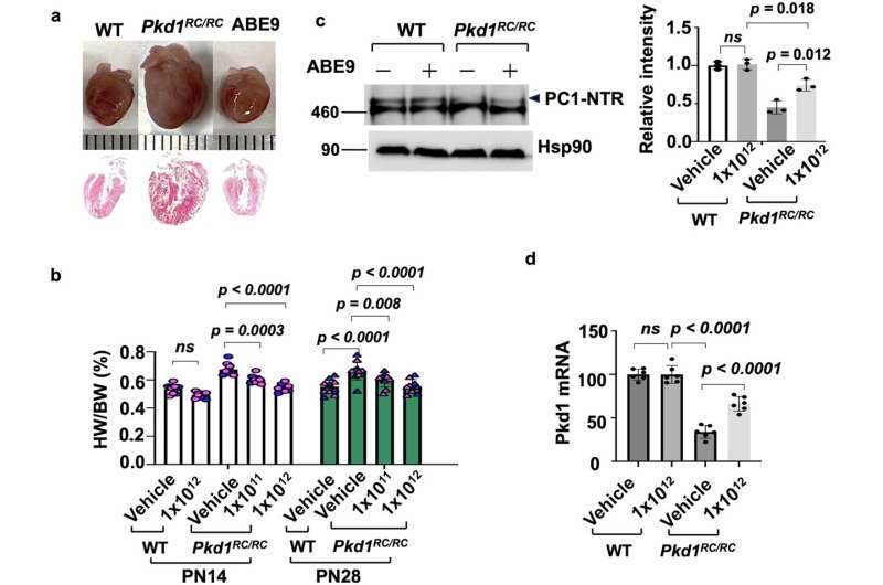 Single Gene Edit Treats Inherited Kidney Disease in Mice - Image 3