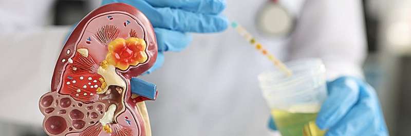 Early Kidney Tests Could Save Millions From Silent Disease - Image 2