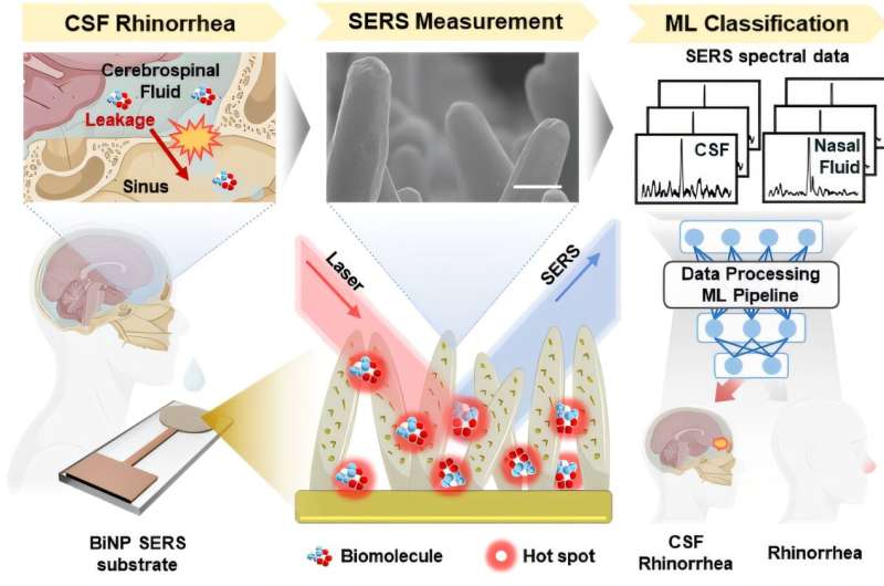 AI Diagnoses Brain Fluid Leaks in Under One Minute - Image 2