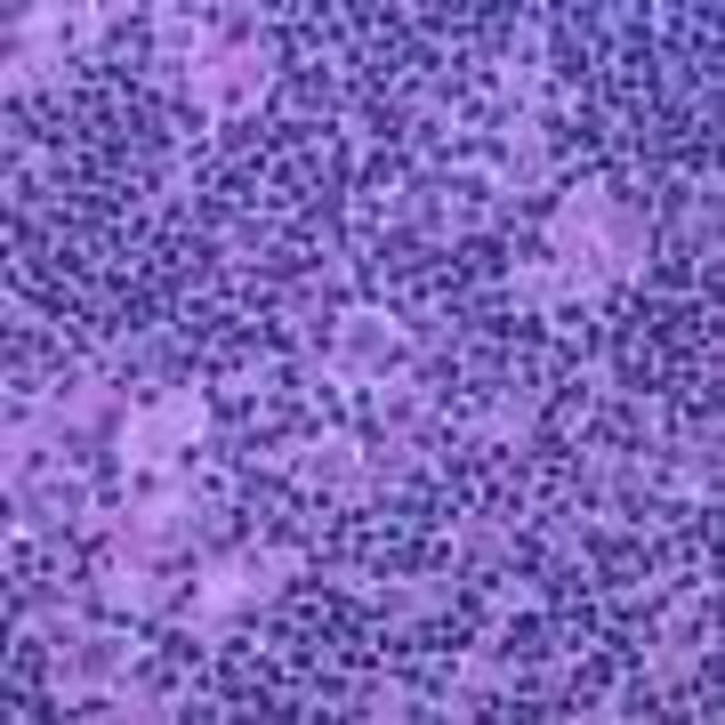 AI Tool Predicts Brain Age and Cancer Survival from MRIs - Image 4