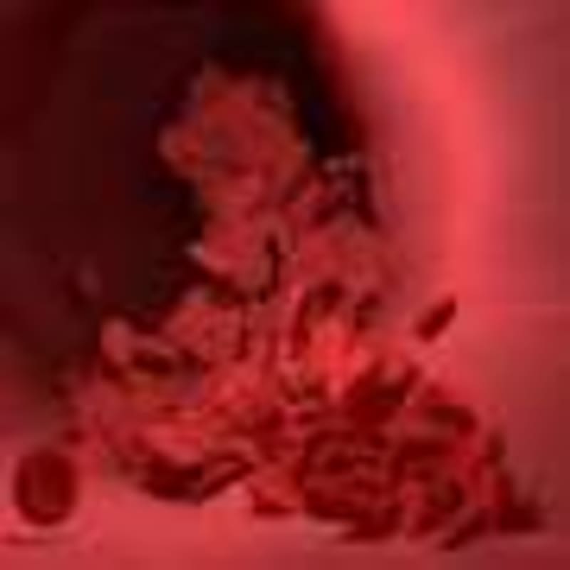 Scientists Find RNA Molecule That Kills Breast Cancer Cells - Image 3