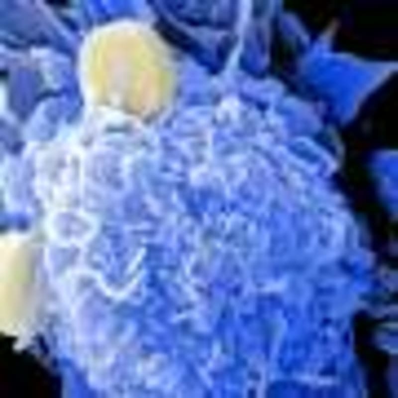 Daily Aspirin Cuts Severe Pregnancy Complication by 29% - Image 5