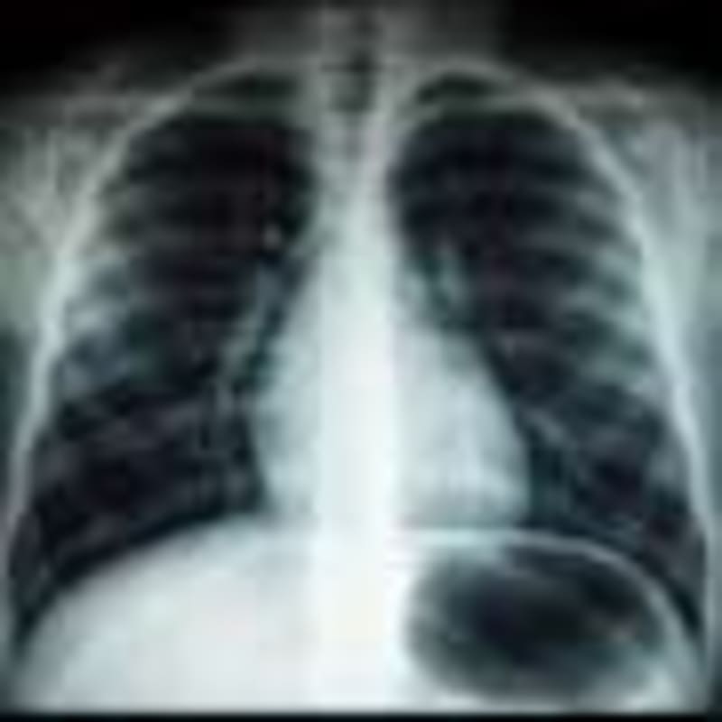 New RSV Vaccine Guidance Could Save Thousands of Lives - Image 5