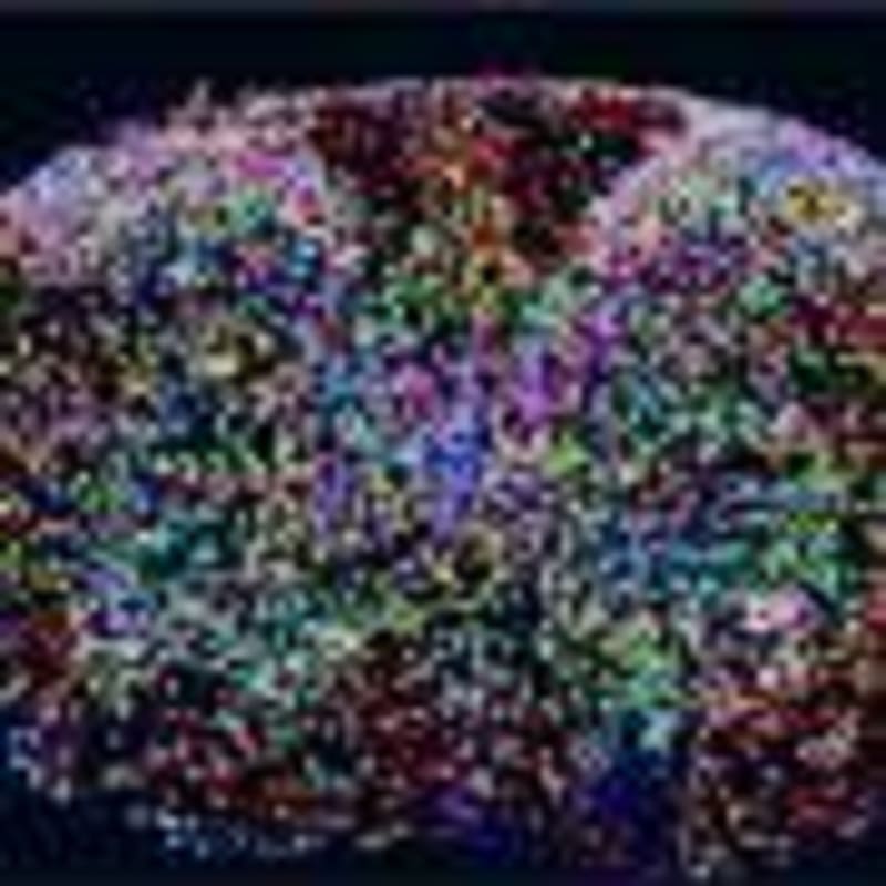 3D-Printed Bandages Help Heal Wounds That Won't Close - Image 4