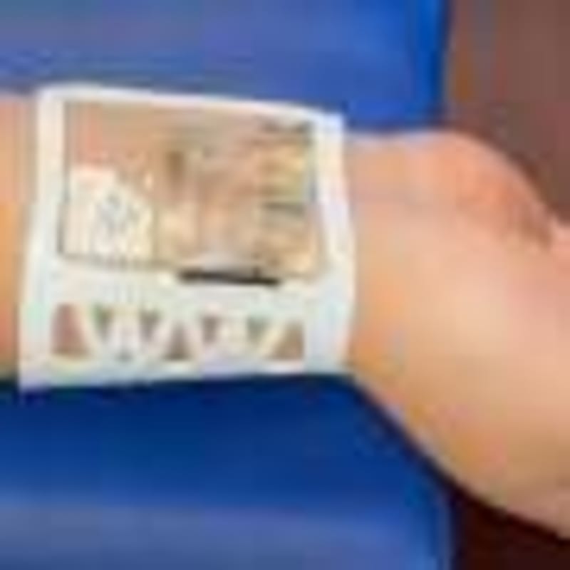 AI Mammograms Cut Aggressive Breast Cancers by 12% - Image 5