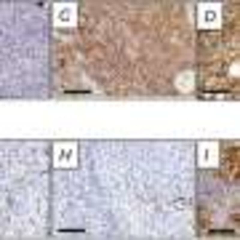 Brain Immune Cells Control What Babies Remember - Image 3