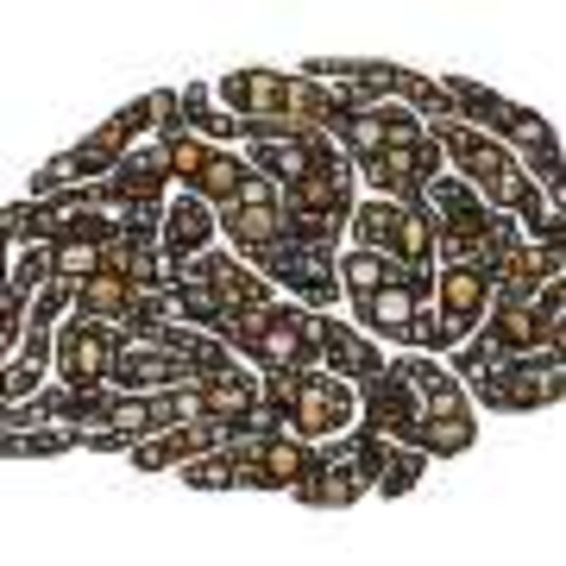 Major Breakthrough: Scientists Unlock Genetic Keys to Help Deaf Children Worldwide - Image 5