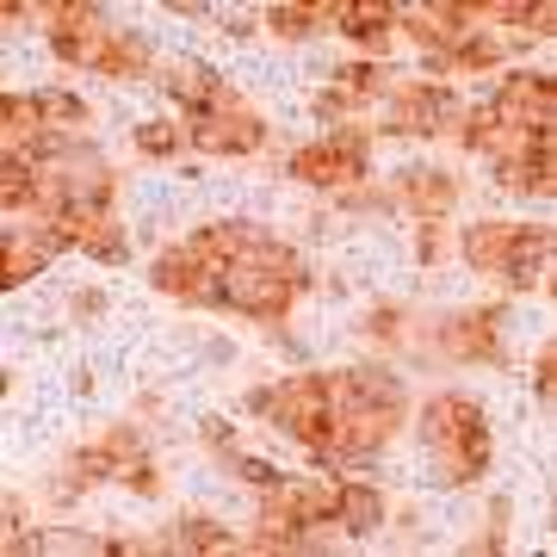 AI Tool Predicts Brain Age and Cancer Survival from MRIs - Image 5