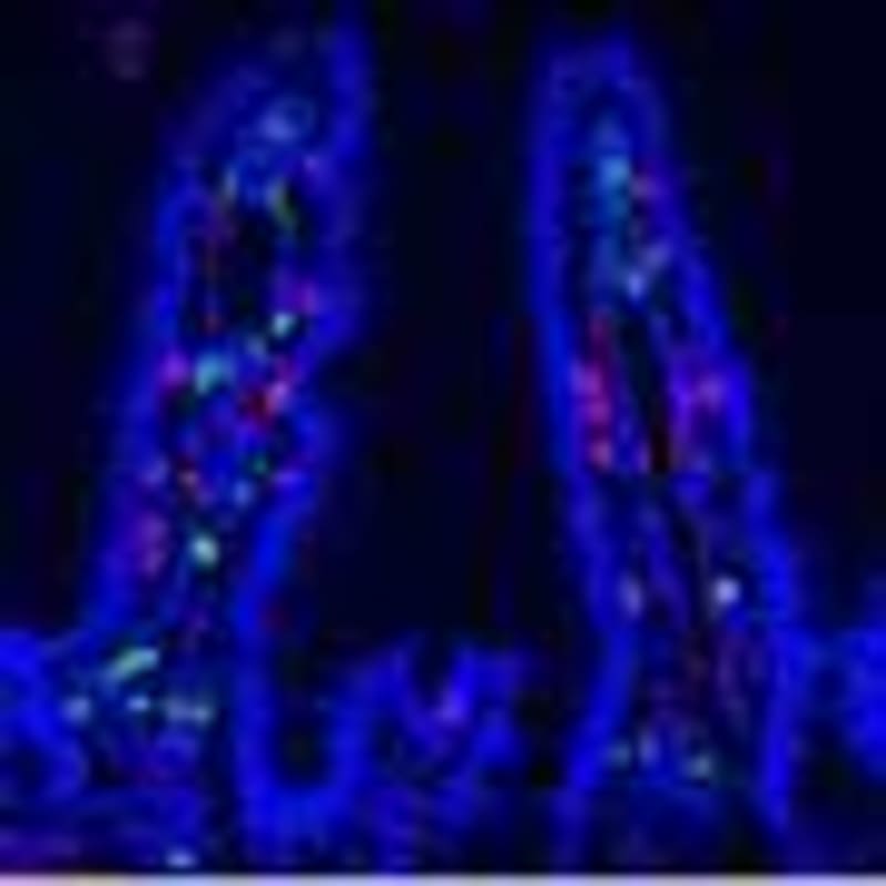 Cutting 1 Liter of Alcohol Yearly Could Save Cancer Lives - Image 5