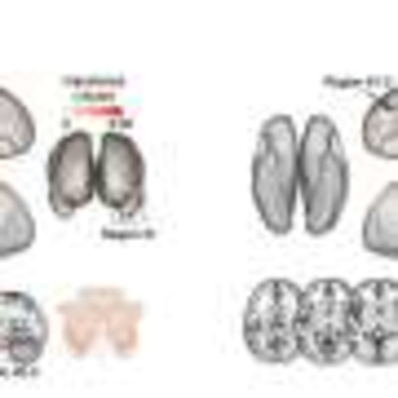 3D-Printed Bandages Help Heal Wounds That Won't Close - Image 5