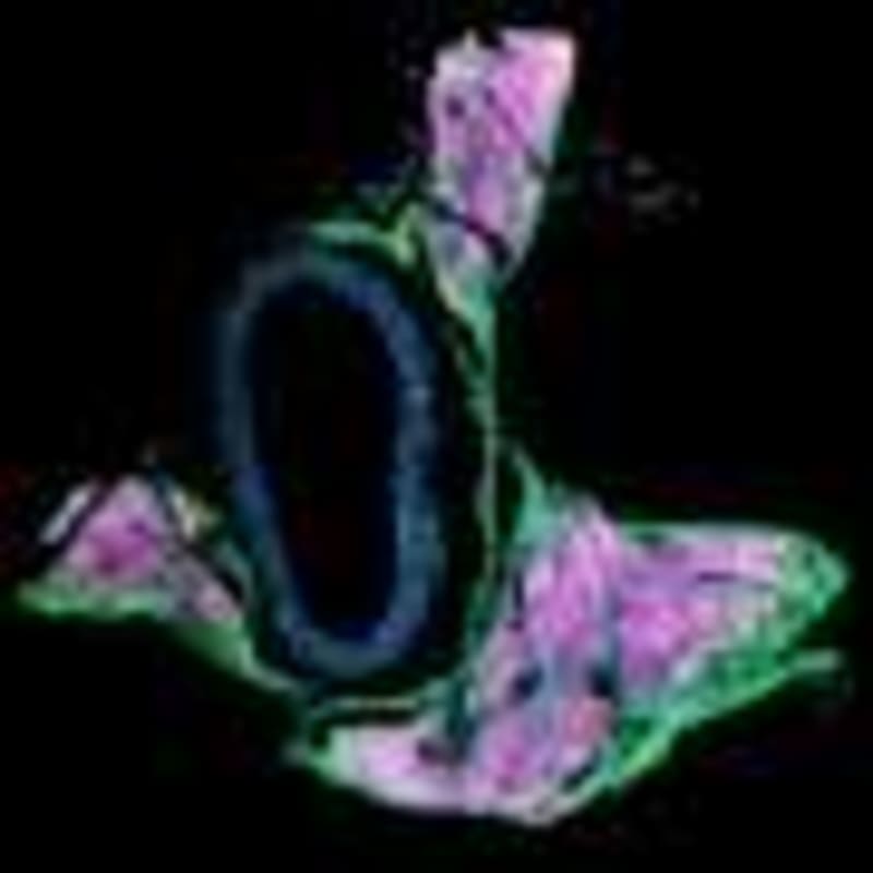 Science Confirms: Yoga, Walking, Exercise All Boost Mood - Image 5