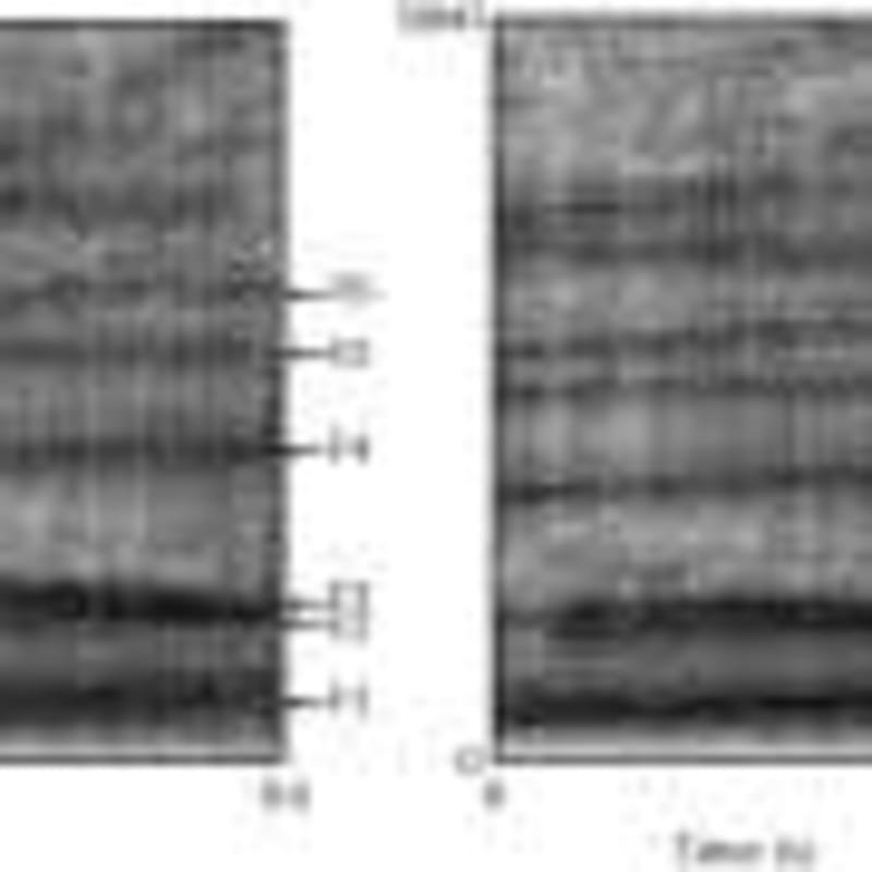 Scientists Find Humane Fix for Australia's Koala Boom - Image 5
