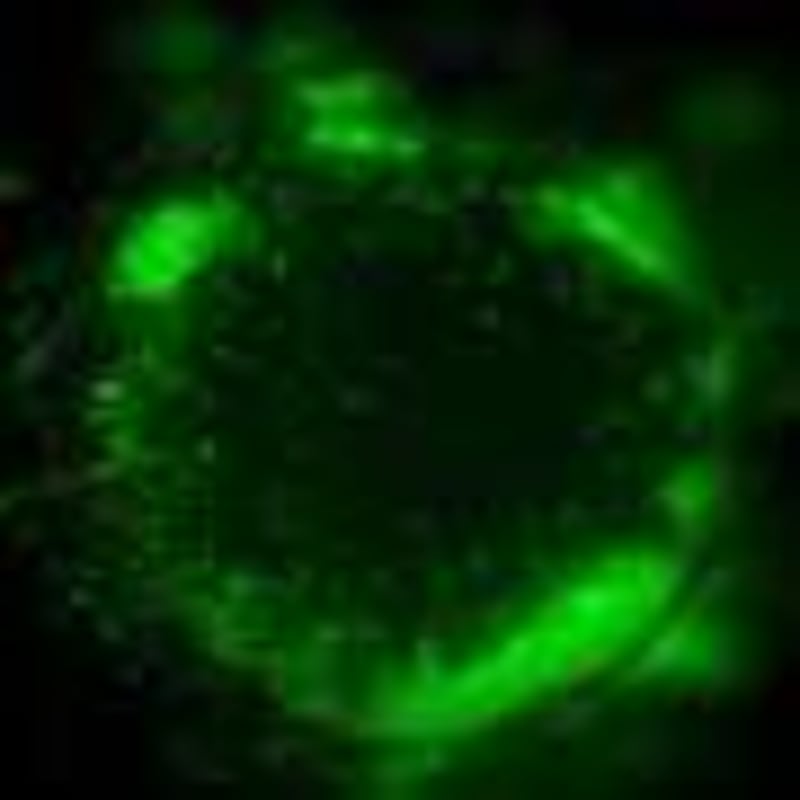 Pillow-Free Sleep May Ease Glaucoma Eye Pressure - Image 4