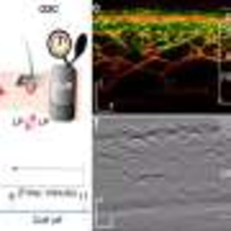 Weight Loss Drugs Cut Sinus Surgery Need by 40% - Image 4