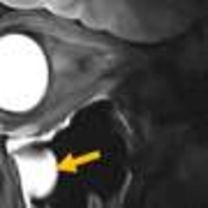 Canada Tackles Brain Injury Crisis Among Unhoused People - Image 5