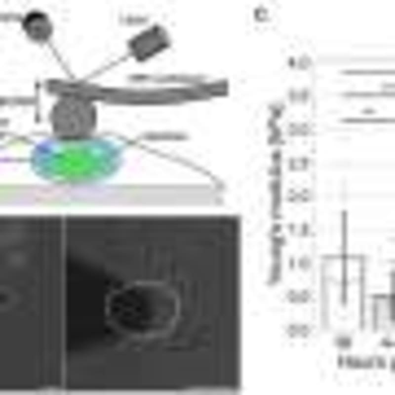 New Stroke Drug Shows 69% Recovery Rate in Major Trial - Image 5