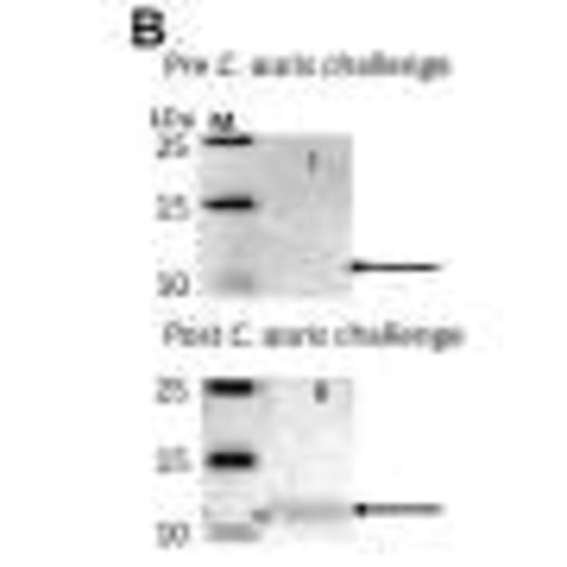 High Schooler Leads Lab Creating Jell-O Brains for TBI - Image 5