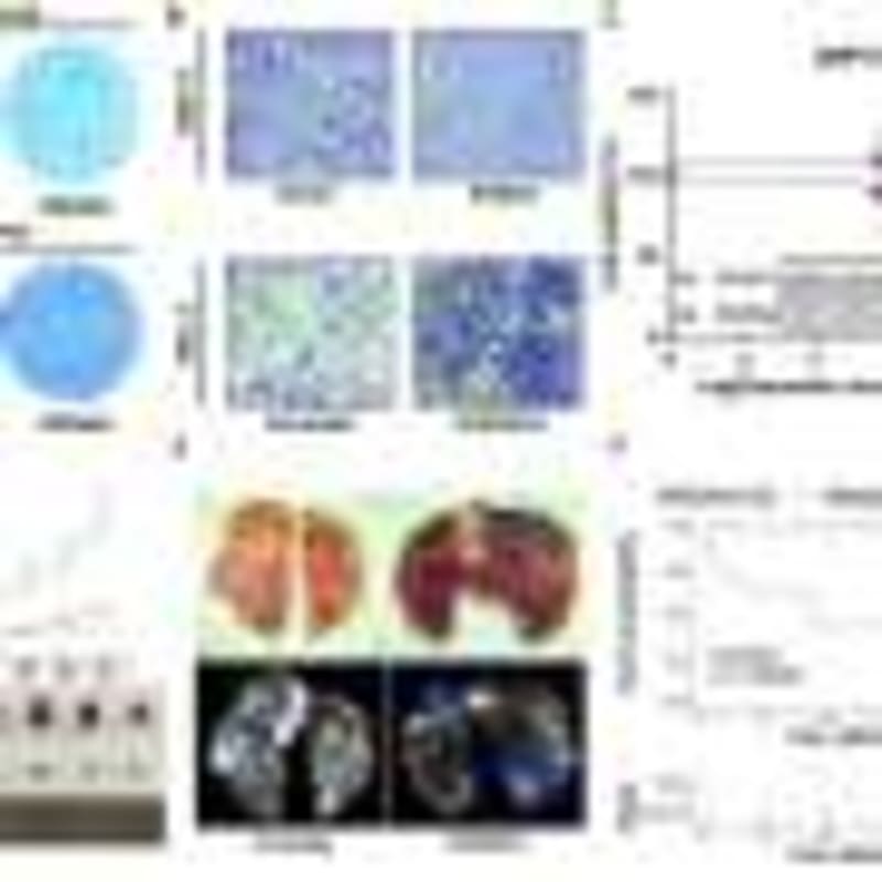 Cancer Drug Reawakens Failed Immunotherapy for 6 Patients - Image 5
