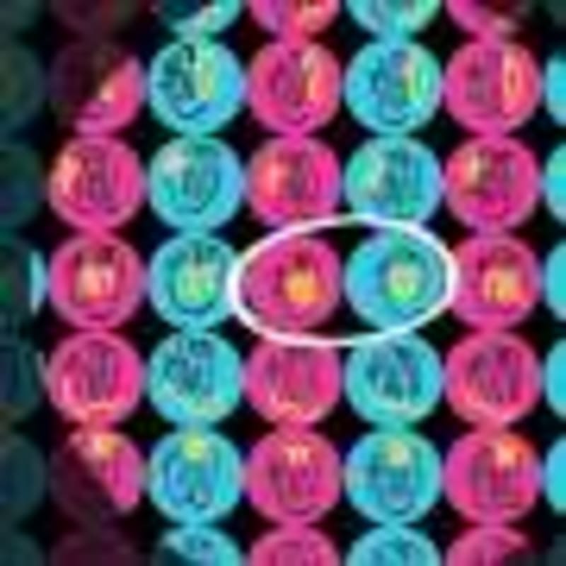 New OCD App Shows 65% Success Rate in Mass General Trial - Image 4