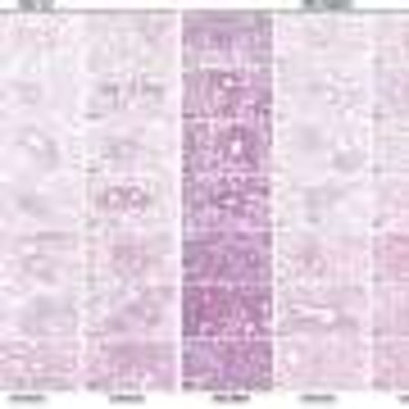 Melbourne Team Creates New Therapy for Teen Eating Disorder - Image 5