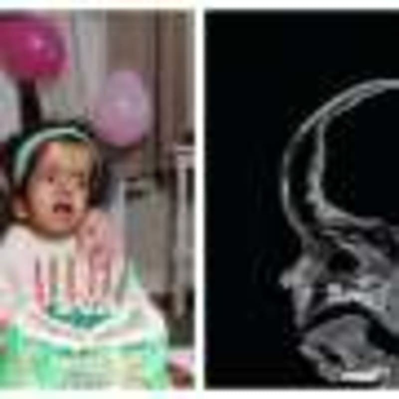 Scientists Map Brain Protein to Help 20+ Memory Diseases - Image 3