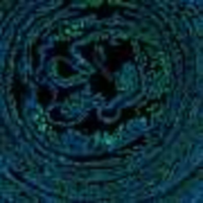 Stem Cells Show Promise for Premature Babies' Brain Injury - Image 4