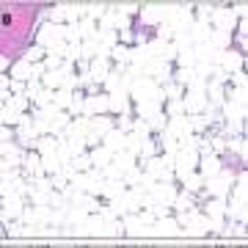 Cut Junk Food for Health and Planet, Finnish Study Finds - Image 5