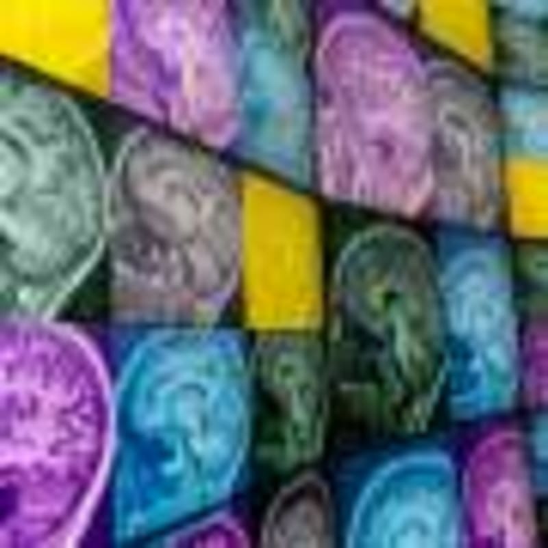 Lego Task Reveals New Path to Earlier Autism Detection - Image 4