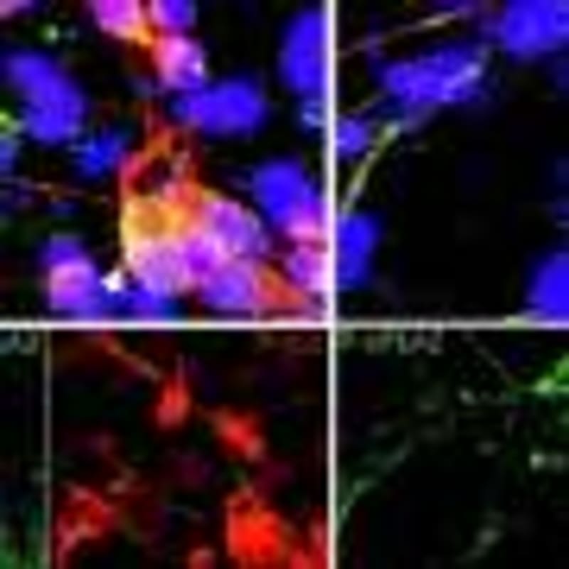 Boston Clinic Finds Key to Protecting Young Women from HIV - Image 5