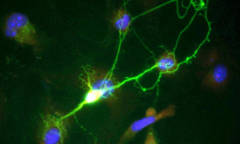Scientists Crack Code of Chronic Pain Neurons - Image 2