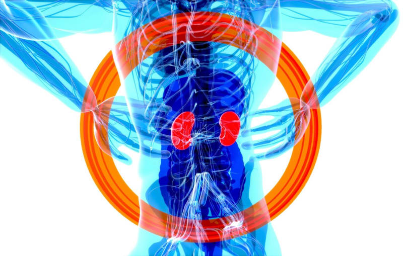 Kidney Cancer Treatment Now Works Without Major Surgery - Image 2
