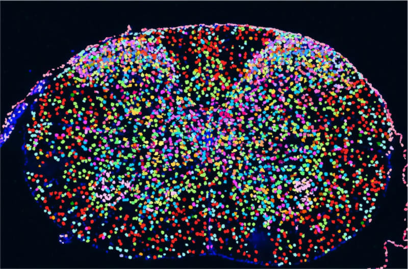 Color-coded scientific map showing different cell types distributed throughout spinal cord tissue sections