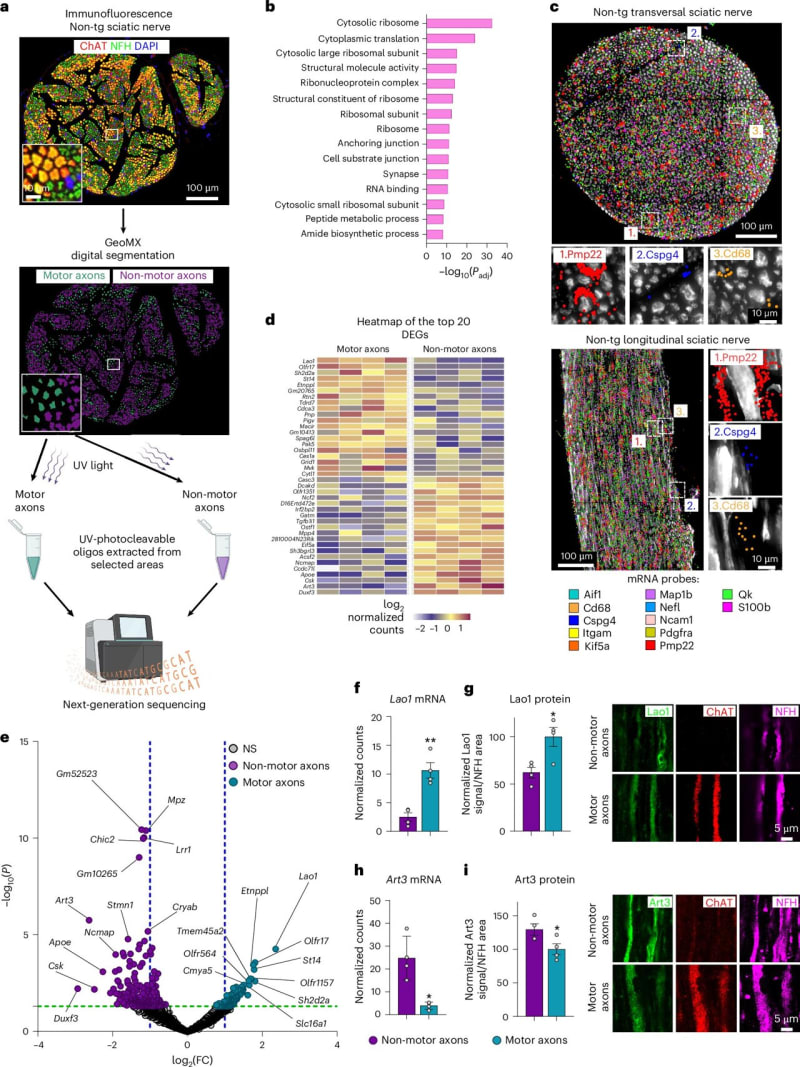 Belgian Scientists Find New Hope for ALS Treatment - Image 2