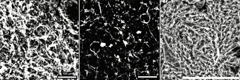 Comparison showing dense blood vessels in young fish versus sparse vessels in aged fish