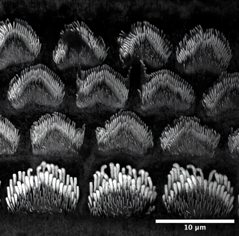 Scientists Find New Way to Prevent Permanent Hearing Loss