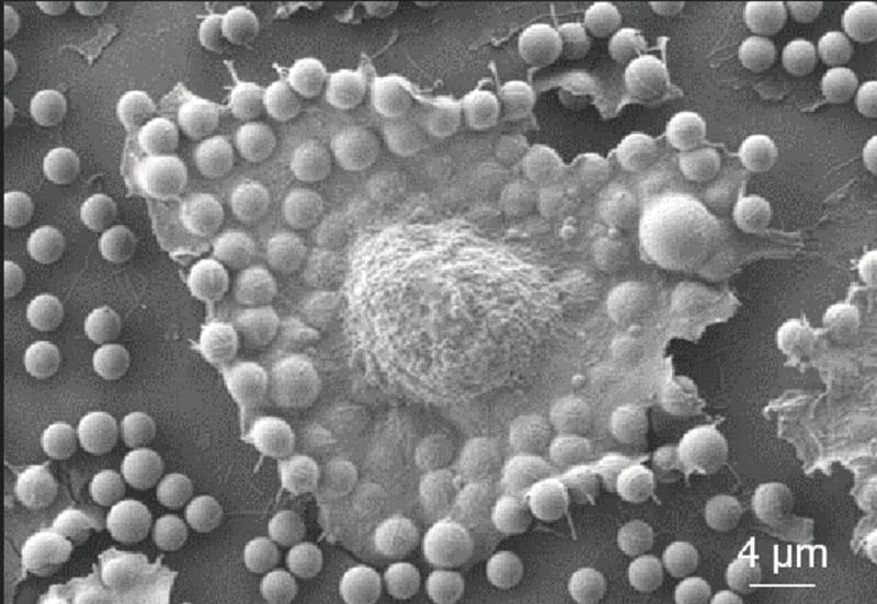 Cancer Test Uses Physics to Spot Aggressive Cells Fast - Image 2