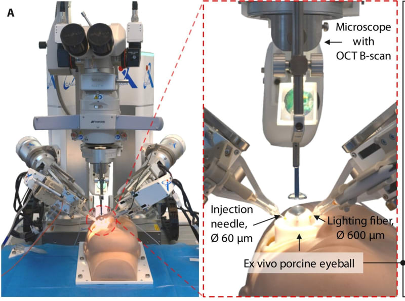 Robot Successfully Performs Delicate Eye Surgery on Pig Eyes - Image 2