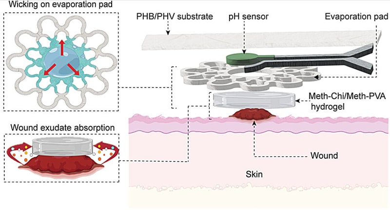 Smart Bandage Tracks Wound Healing in Real Time