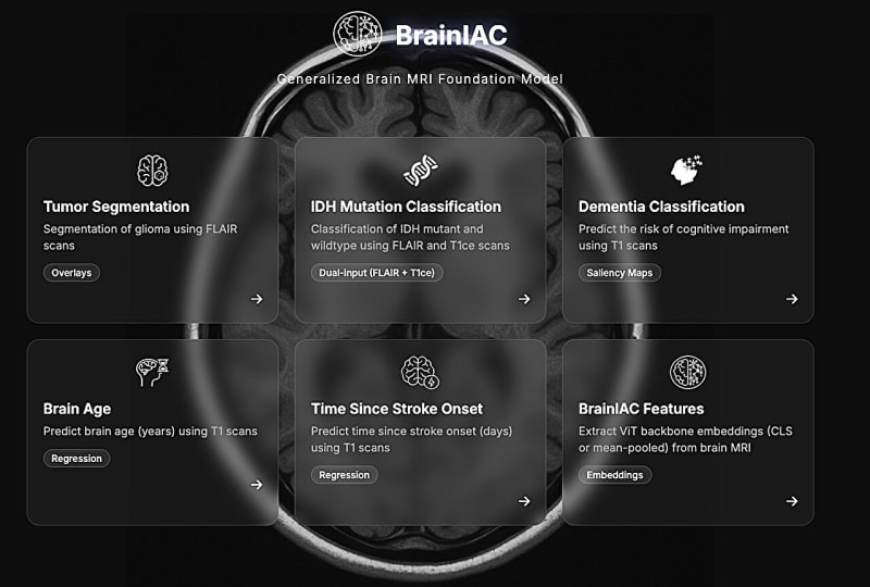 New AI Predicts Brain Disorders From Standard MRI Scans