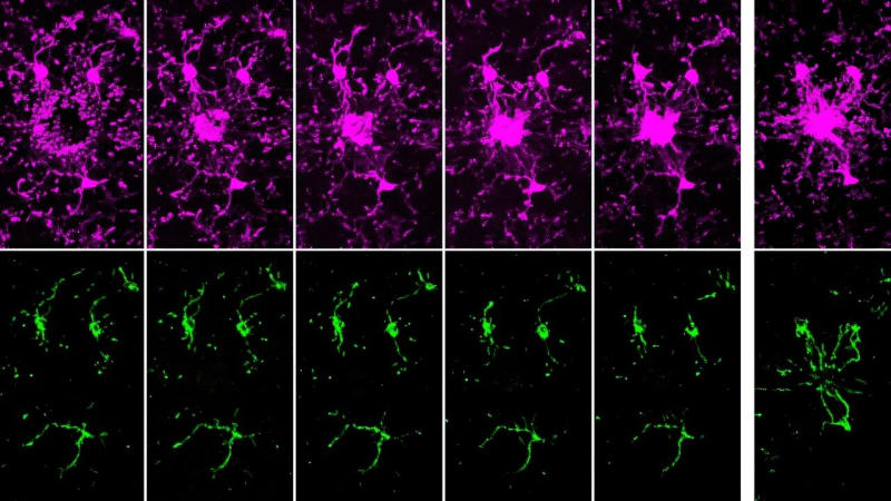 Brain Immune Cells Use Sugar, Then Build Roads for Backup