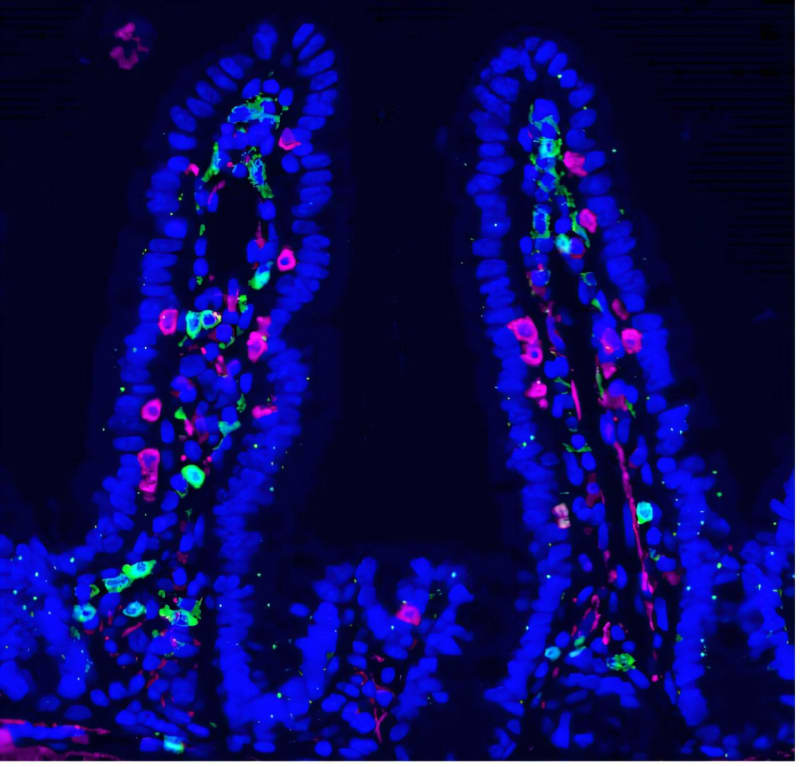 Chemo Side Effect Rewires Immunity to Fight Cancer Spread