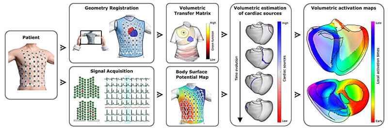 New Heart Tech Maps All 4 Chambers in One Beat