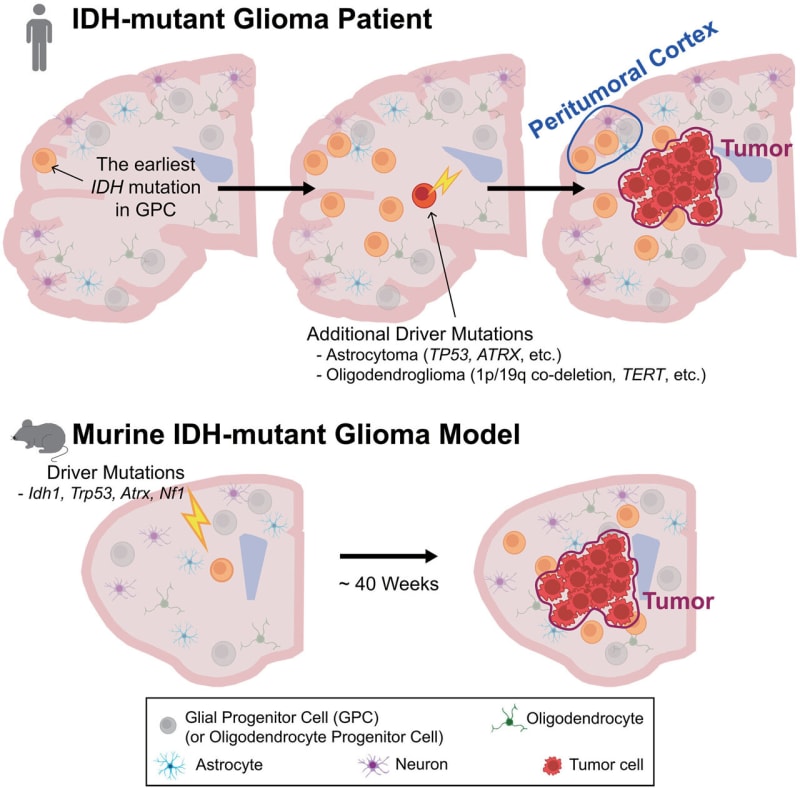 Korean Scientists Discover Brain Cancer Origins, Opening Door to Early Treatment - Image 2